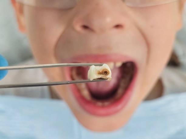 Best Tooth Infection Emergency Dentist  in Windsor, IL